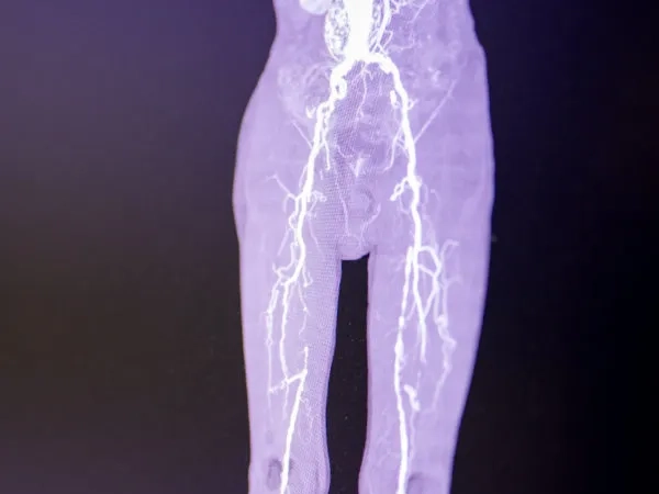 limb